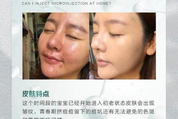 八字与皮肤 八字影响肤质