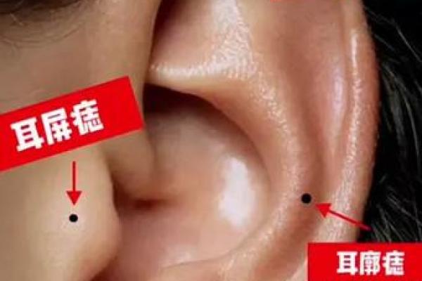 风水上耳朵有痣的人命运