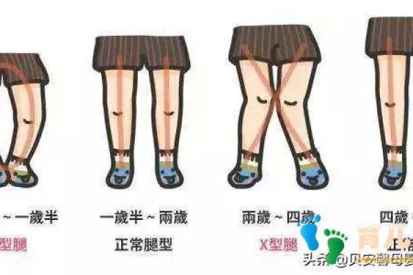 八字腿图片